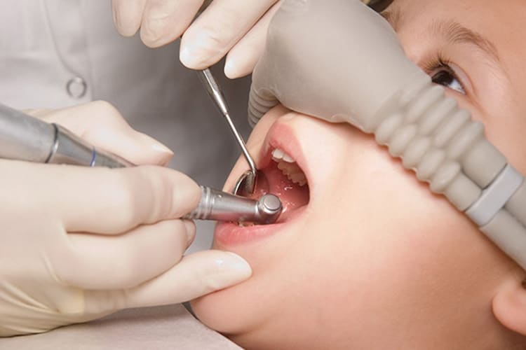Dentist using a drill on a young child's open mouth during a procedure in the dental chair.