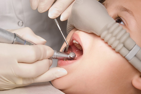 Dental Implants Safe For Kids
