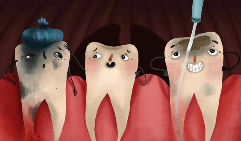 Is It Even Possible to Save a Badly Decayed Tooth?