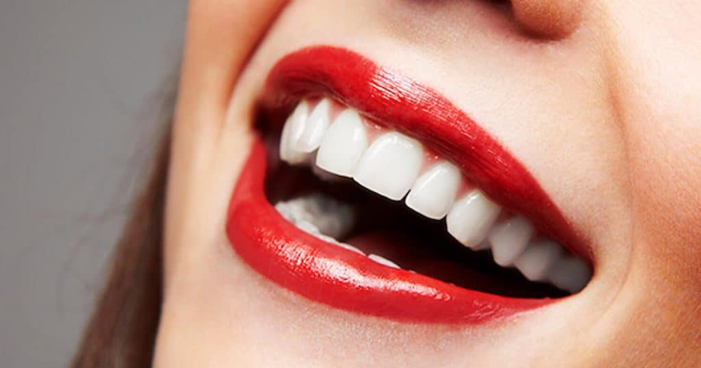 Laughing smile with glossy red lipstick and perfect porcelain veneers.