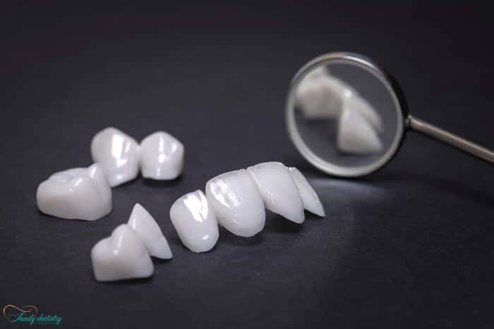 Close-up of porcelain veneers on a matte surface