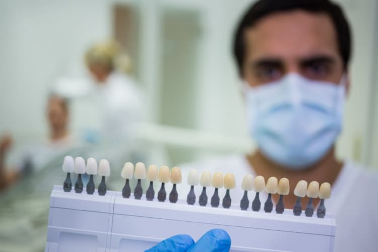 A row of composite veneers being held in front of the camera by a dentist. The focus is on the veneers, with the dentist slightly blurred in the background.