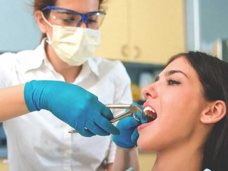 Tooth Extraction