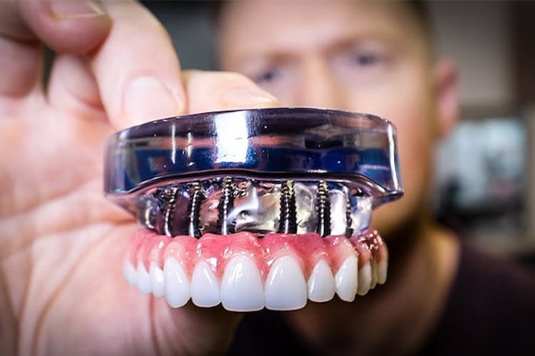 A view of dental prosthesis 