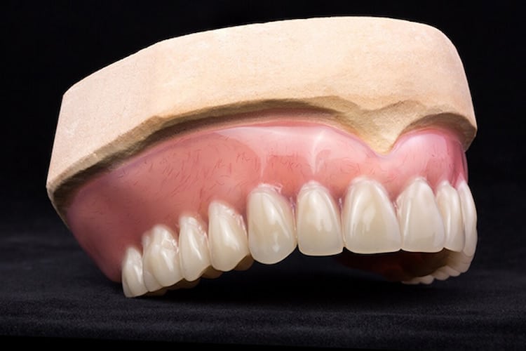 Custom artificial teeth model on a black surface.