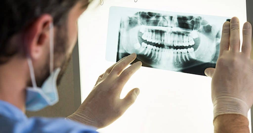 Dentist holding up and demystifying dental X-rays for a patient.