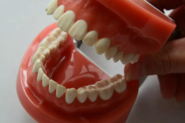a tooth model showing how Dentures benefit you