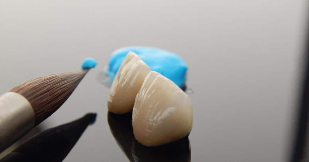 two dental crowns with dental crown glue on a smooth surface.