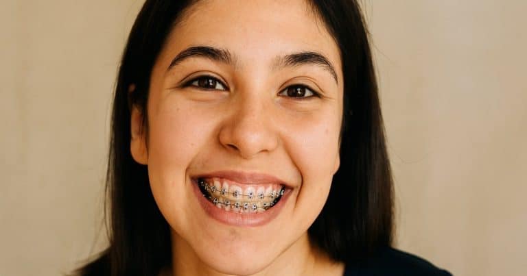 Braces Placement Timeline for Top and Bottom Teeth: The Complete Process