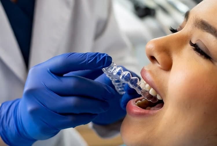 a dentist putting Clear Aligners for a patient