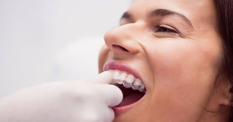 Invisalign Pain Relief for Comfort