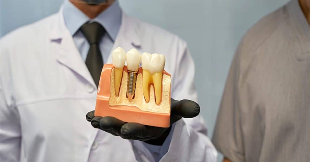 Does CDCP Cover Dental Implants in 2026?