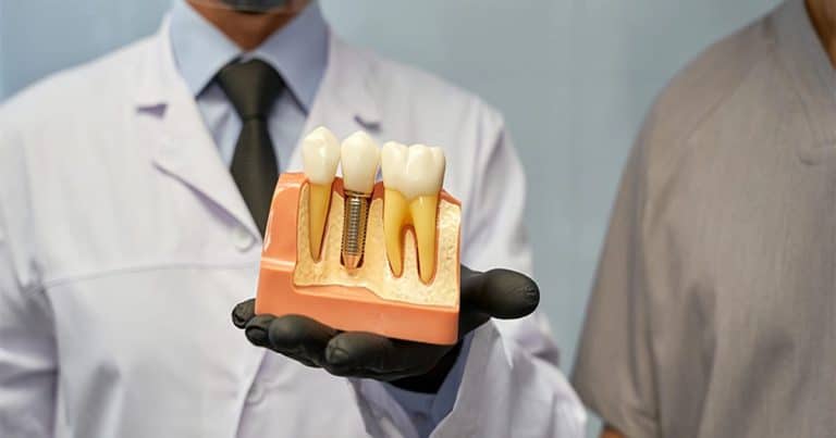 Does CDCP Cover Dental Implants in 2026?