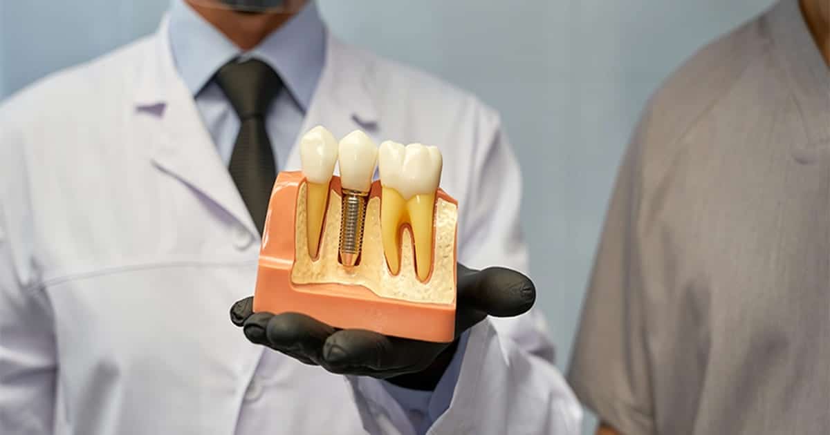 Does CDCP Cover Dental Implants in 2026?
