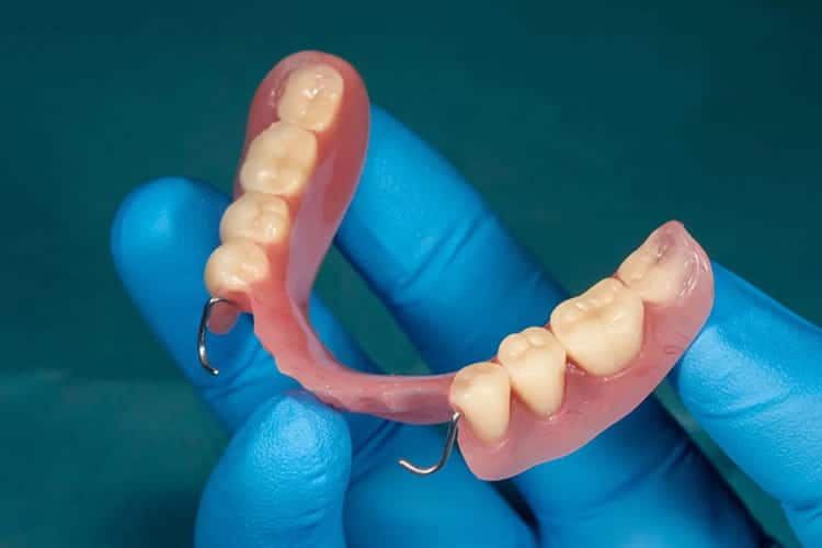 Removable Partial Dentures