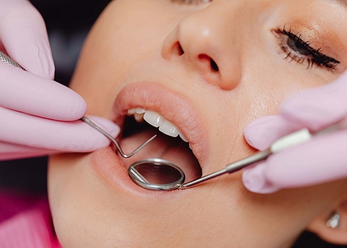 dental cleaning procedure