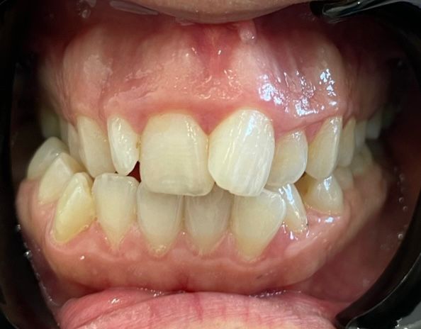 Ortho 1A