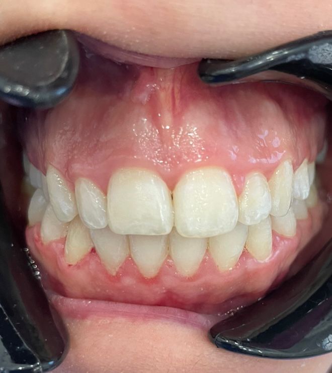 Ortho 1B